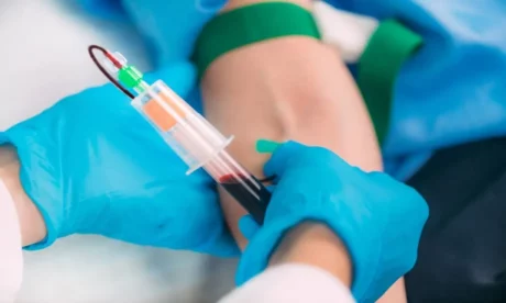 Advance Phlebotomy Training Course with Experience Opportunity